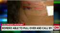 romero neck exit wound on her right.png