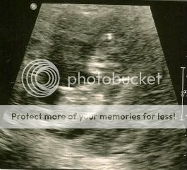 12weeks3days.jpg