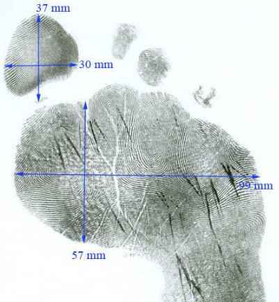 sollecito_forefoot_measurements.jpg
