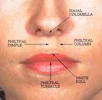 philtrum.jpg