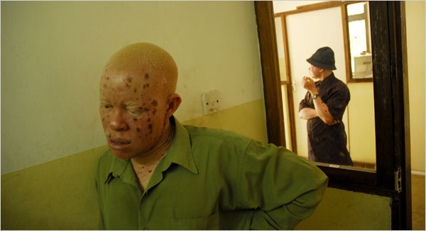 08albino-span-600.jpg