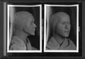 Case Photo