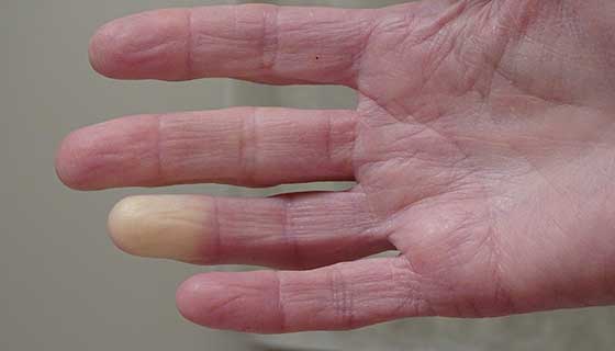 www.hopkinsmedicine.org