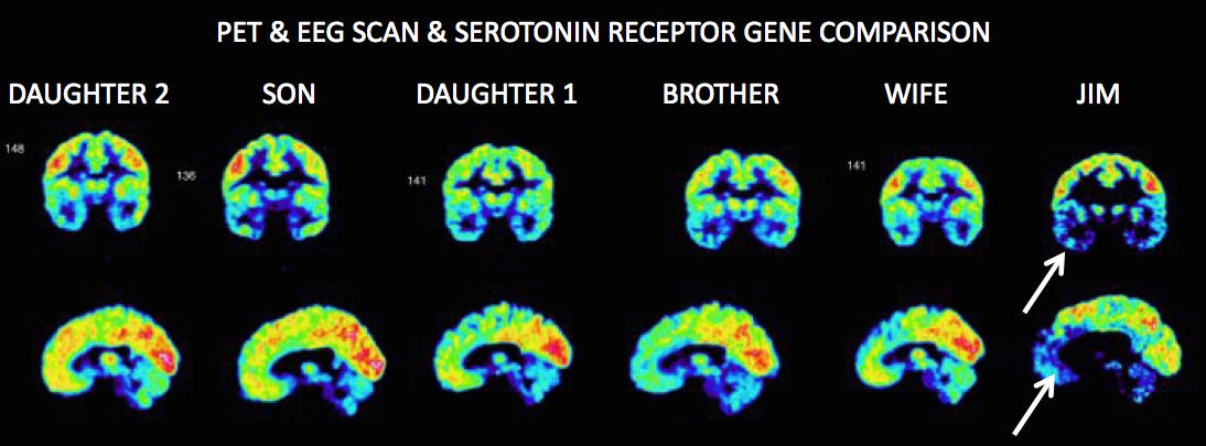 fallon-brain-scans.jpg