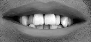 238UFOKTeeth.jpg