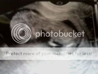 12weeks3daysanothershot.jpg