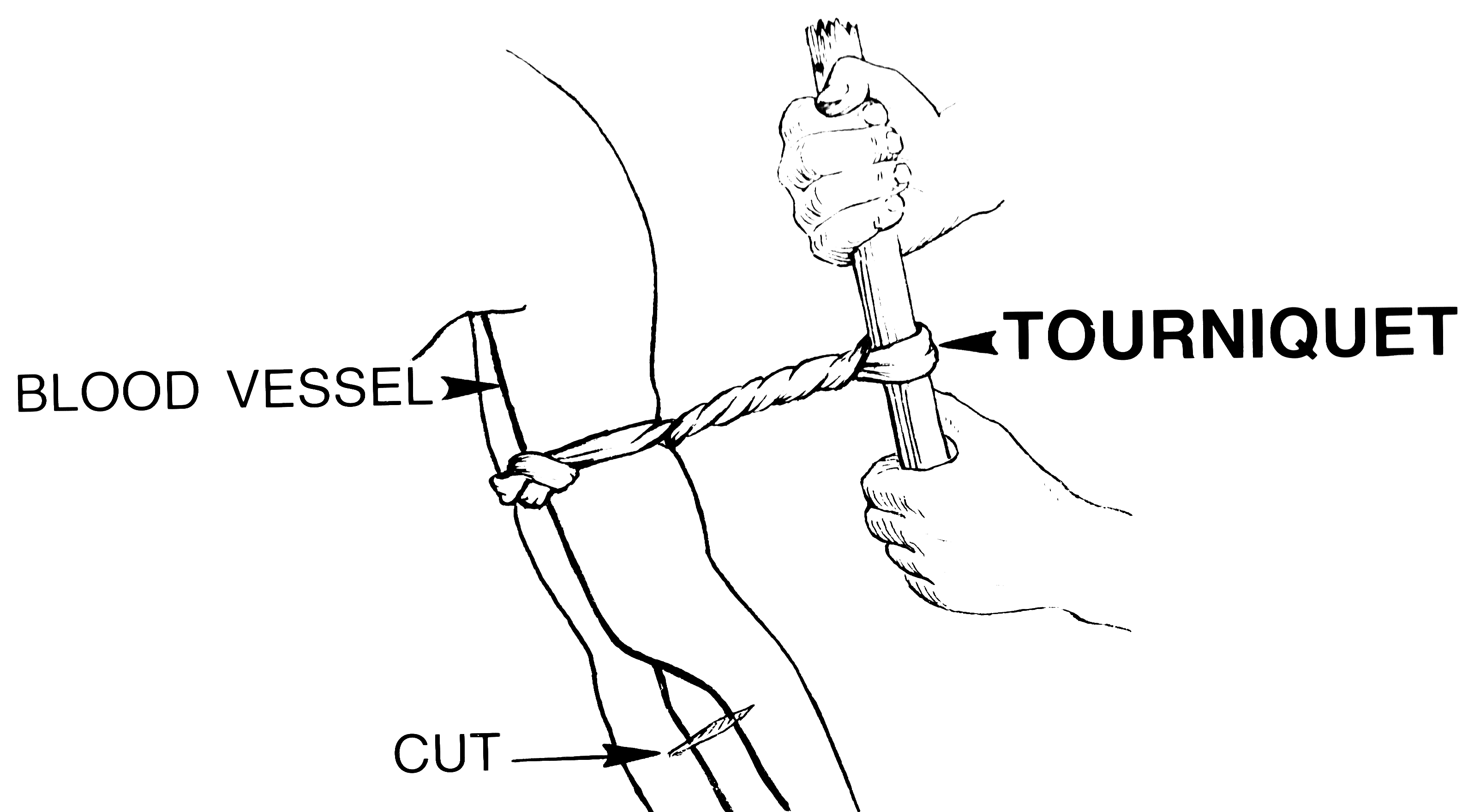 Tourniquet_(PSF).png