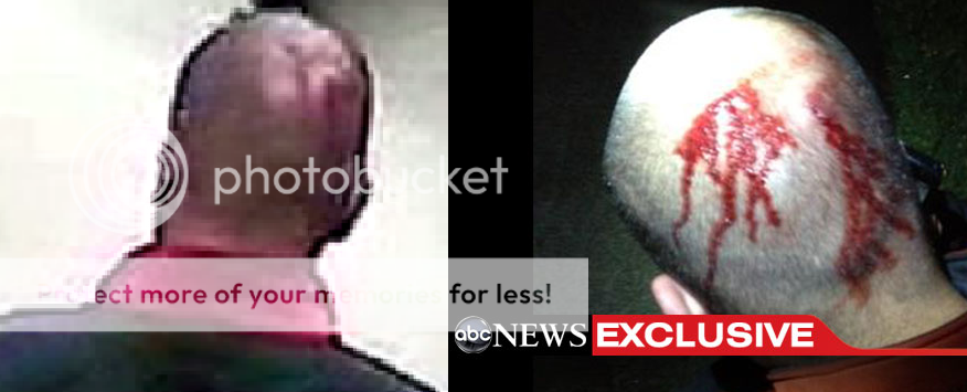 TMGZInjury.png