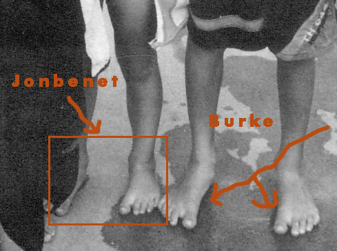 JonBenetAndBurkesFeet.jpg
