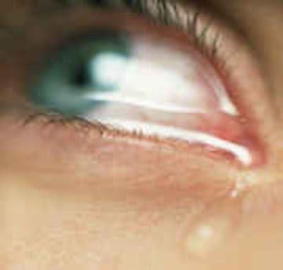 eye-crying.jpg