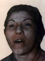 Facial Case Id