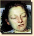 Case Photo