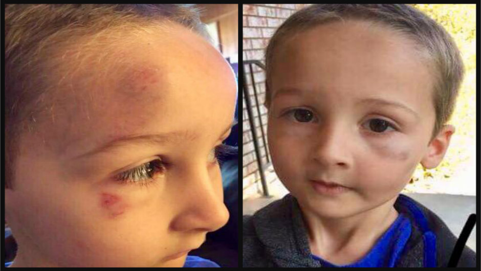 lucas-hernandez-1-jpg.134951