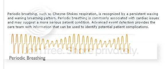 RespironicsPeriodicBreathing_Descri.jpg