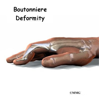finger_bouton_intro01.jpg