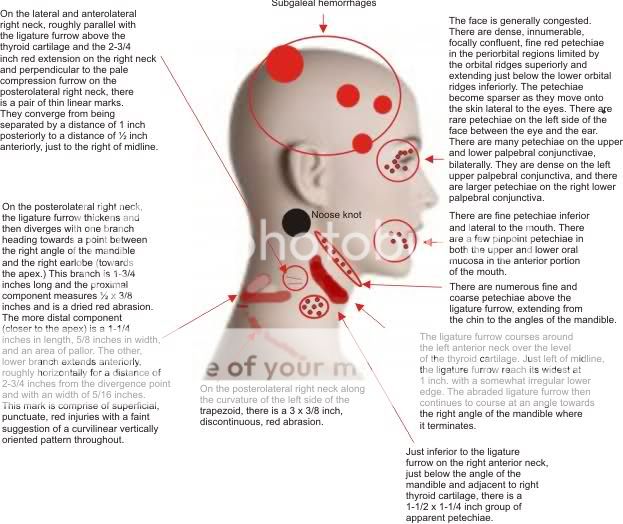 rz_head_cynic_zps305706b6.jpg