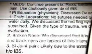 georgenosutures.jpg
