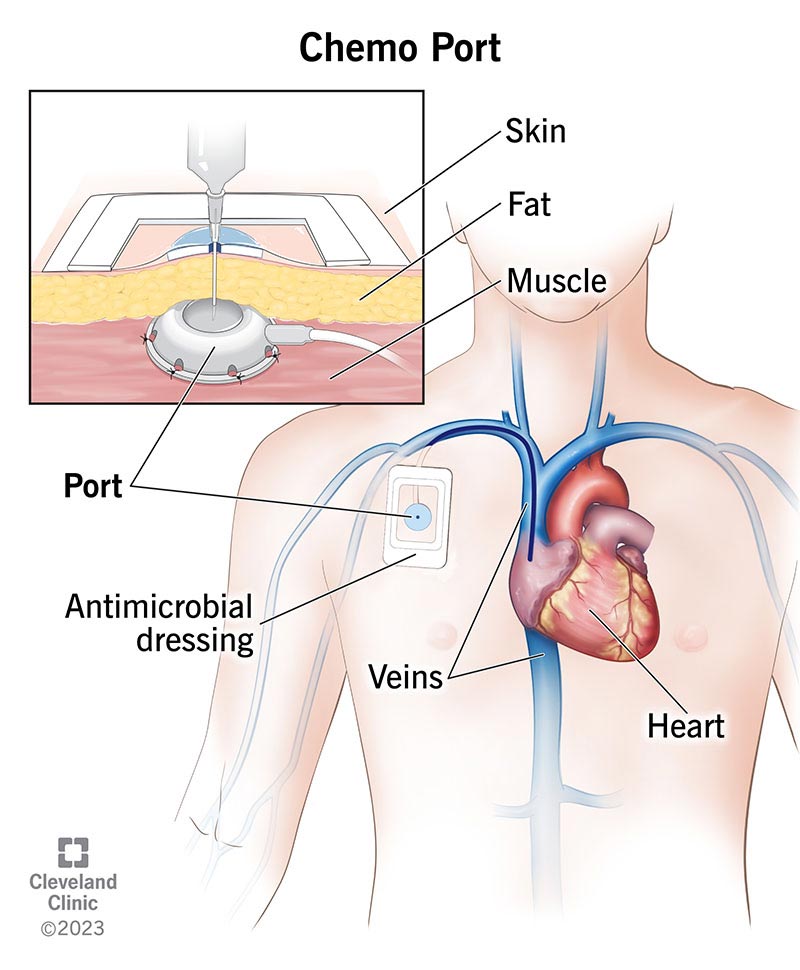 my.clevelandclinic.org