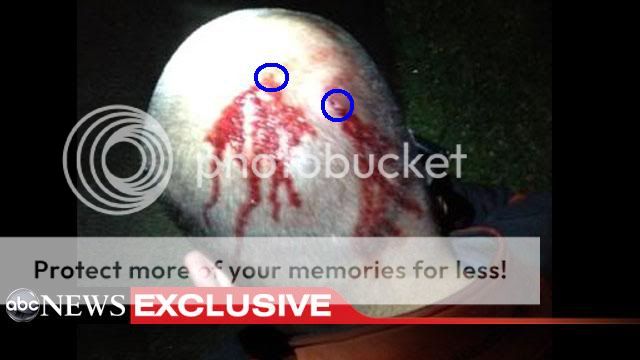 Georgesbooboo.jpg