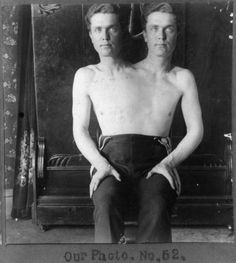 d96ed7a73914c51ff8aaeb66a8e380cf--conjoined-twins-freak-show.jpg