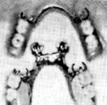 239UFONDentures.jpg