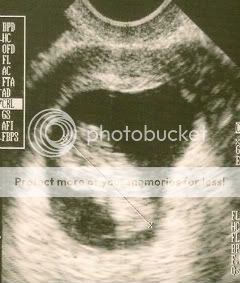 10weeks.jpg